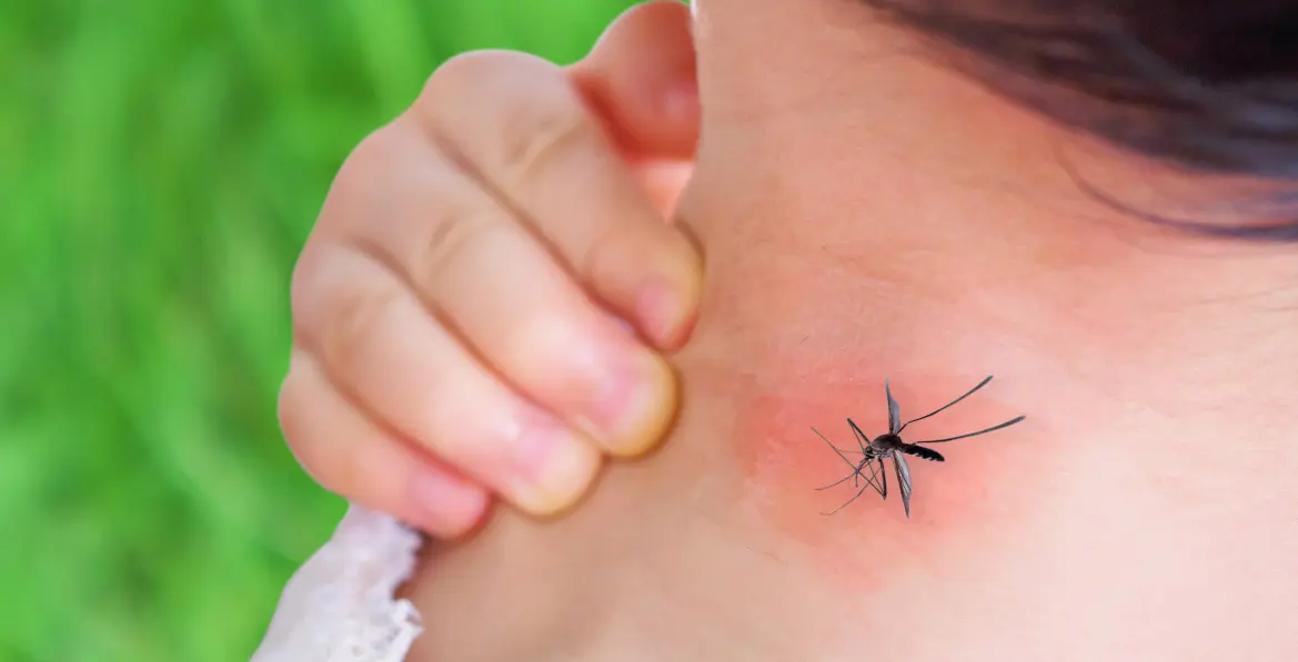 5 запахов, которые комары боятся, и 5 вещей, которые их привлекают